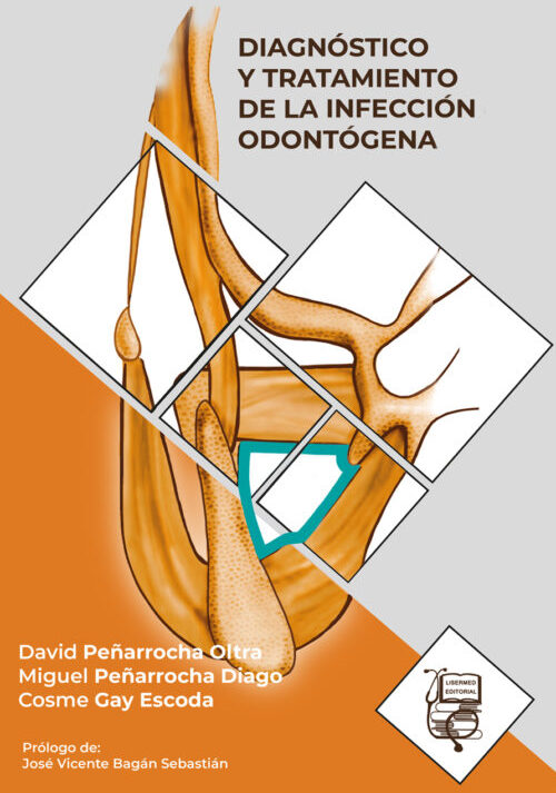 DIAGNOSTICO Y TRATAMIENTO DE LA INFECCION ODONTOGENA 01 / 2022