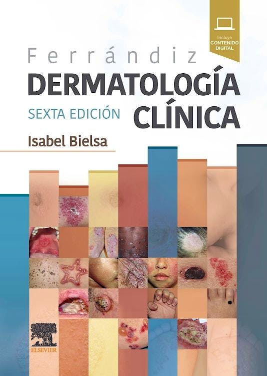 FERRANDIZ. DERMATOLOGIA CLINICA 06 / 2025