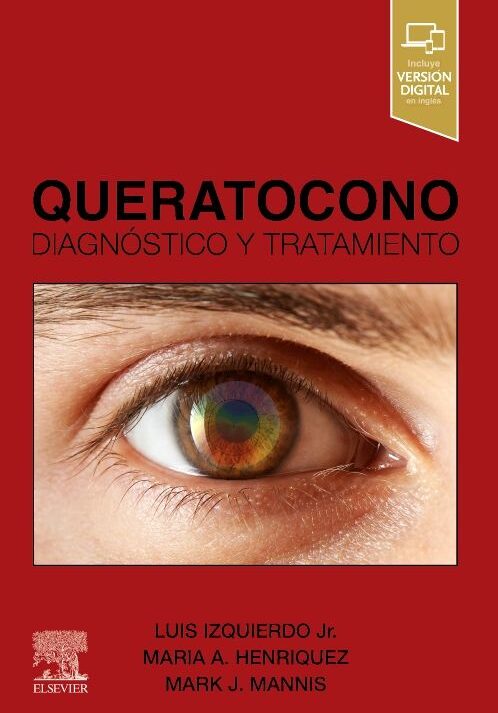 QUERATOCONO. DIAGNOSTICO Y TRATAMIENTO 01 / 2024