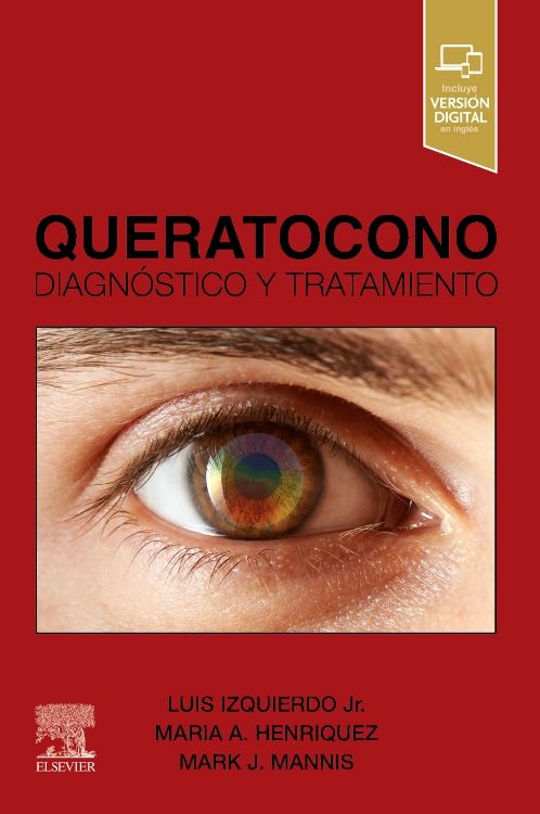 QUERATOCONO. DIAGNOSTICO Y TRATAMIENTO 01 / 2024