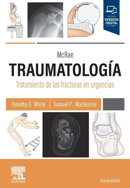 MCRAE. TRAUMATOLOGIA. TRATAMIENTO DE LAS FRACTURAS EN URGENCIAS 04 / 2024