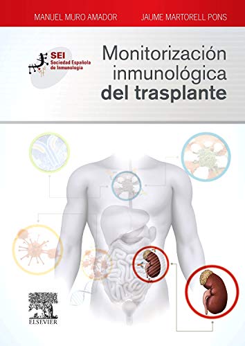 MONITORIZACION INMUNOLOGICA DEL TRASPLANTE 01 / 2015