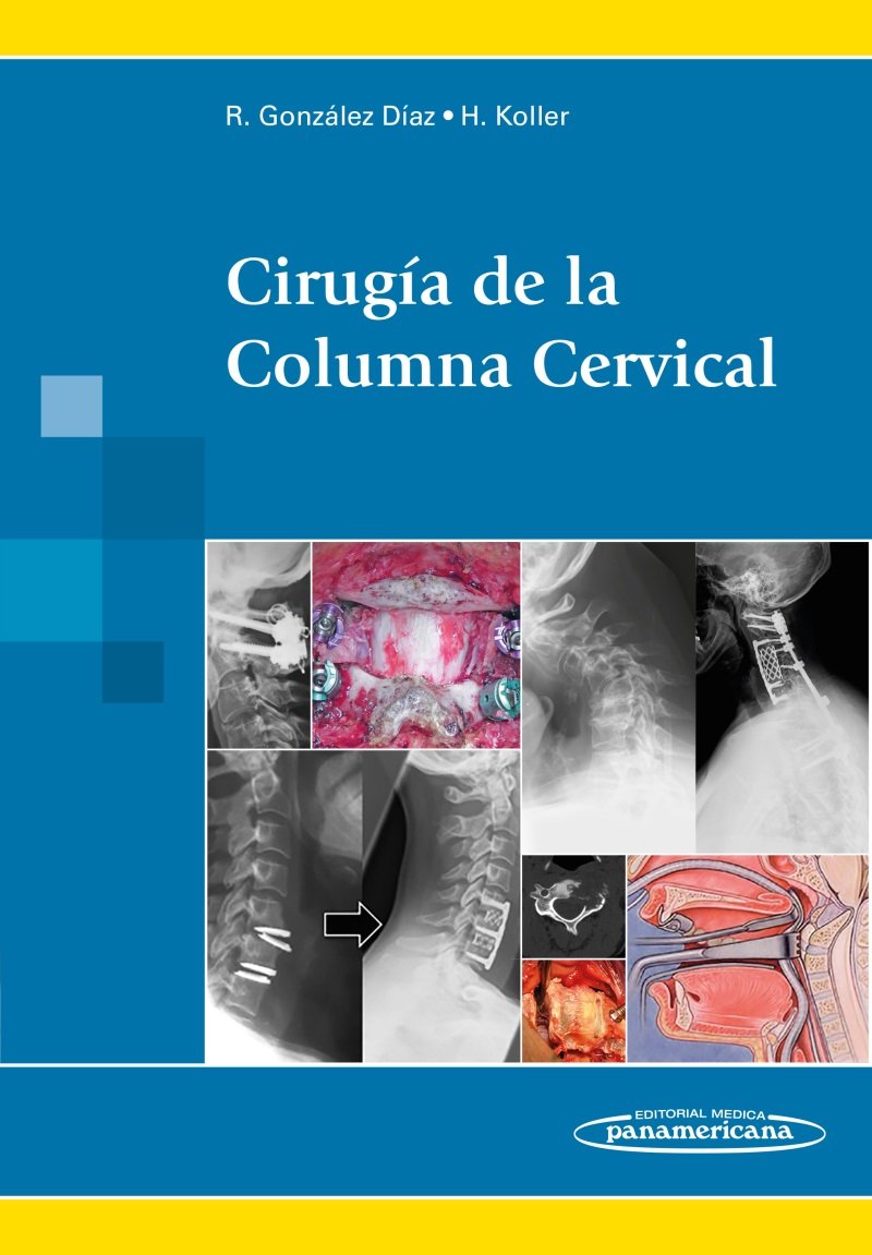 CIRUGIA DE LA COLUMNA CERVICAL 01 / 2015