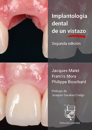 IMPLANTOLOGIA DENTAL DE UN VISTAZO 02 / 2023