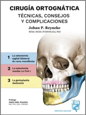 CIRUGIA ORTOGNATICA. TECNICAS, CONSEJOS Y COMPLICACIONES 01 / 2023
