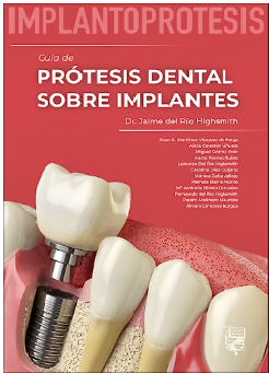 IMPLANTOPROTESIS. GUIA DE PROTESIS DENTAL SOBRE IMPLANTES 01 / 2024