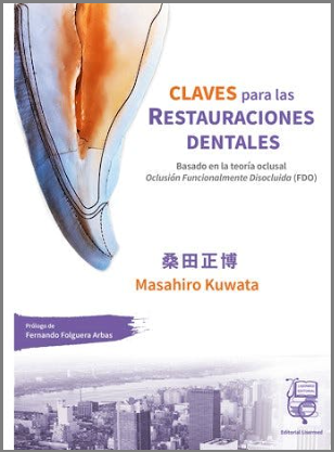 CLAVES PARA LAS RESTAURACIONES DENTALES BASADO EN LA TEORIA OCLUSAL OCLUSION FUNCIONALMENTE DISOCLUIDA (FDO) 01 / 2024