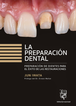 PREPARACION DENTAL. PREPARACION DE DIENTES PARA EL EXITO DE LAS RESTAURACIONES 01 / 2024