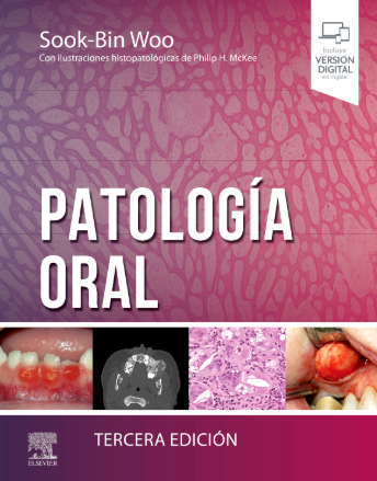 PATOLOGIA ORAL 03 / 2024