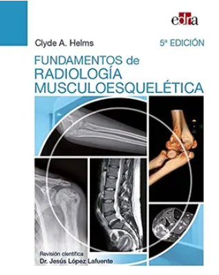 FUNDAMENTOS DE RADIOLOGIA MUSCULOESQUELETICA 05 / 2021