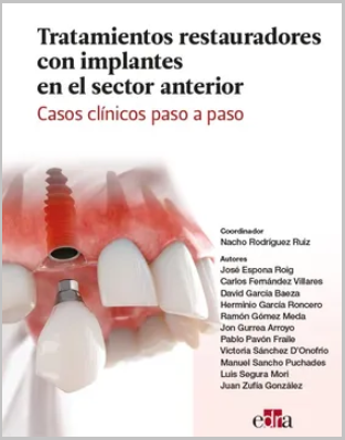TRATAMIENTOS RESTAURADORES CON IMPLANTES EN EL SECTOR ANTERIOR. CASOS CLINICOS PASO A PASO 01 / 2022