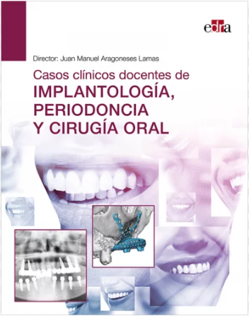 CASOS CLINICOS DOCENTES DE IMPLANTOLOGIA, PERIODONCIA Y CIRUGIA ORAL 01 / 2022
