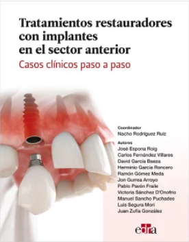 TRATAMIENTOS RESTAURADORES ESTETICOS CON COMPOSITES Y CERAMICAS EN EL SECTOR ANTERIOR. CASOS PRACTICOS PASO A PASO 01 / 2024