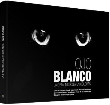 OFTALMOLOGIA EN COLORES: EL OJO BLANCO 01 / 2012