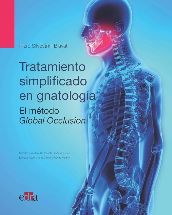 TRATAMIENTO SIMPLIFICADO EN GNATOLOGIA. EL METODO GLOBAL OCCLUSION 01 / 2020
