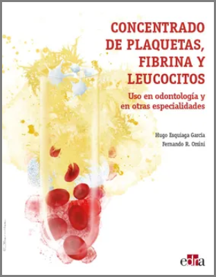 CONCENTRADO DE PLAQUETAS, FIBRINA Y LEUCOCITOS. USO EN ODONTOLOGIA Y EN OTRAS ESPECIALIDADES 01 / 2020