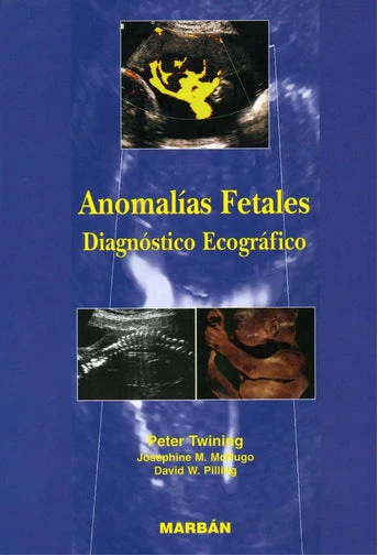 ANOMALIAS FETALES. DIAGNOSTICO ECOGRAFICO 01 / 2002