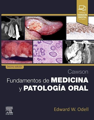 CAWSON. FUNDAMENTOS DE MEDICINA Y PATOLOGIA ORAL 10 / 2025