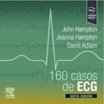 160 CASOS DE ECG 06 / 2025