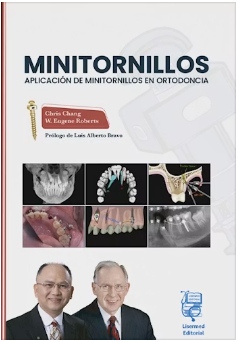 MINITORNILLOS. APLICACION DE MINITORNILLOS EN ORTODONCIA 01 / 2026