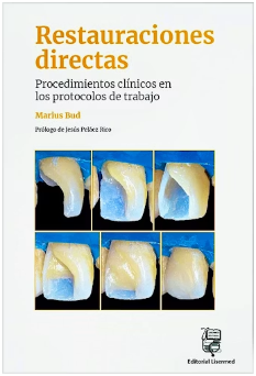 RESTAURACIONES DIRECTAS. PROCEDIMIENTOS CLINICOS EN LOS PROTOCOLOS DE TRABAJO 01 / 2026