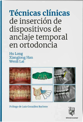 TECNICAS CLINICAS DE INSERCION DE DISPOSITIVOS DE ANCLAJE TEMPORAL EN ORTODONCIA 01 / 2026