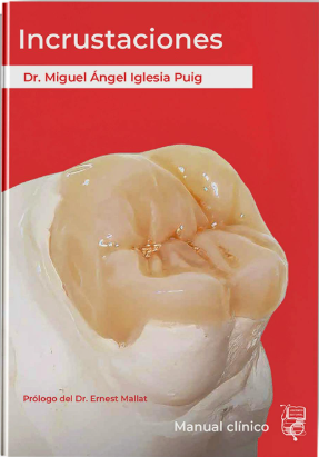 INCRUSTACIONES. MANUAL CLINICO 01 / 2026